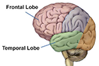 Frontotemporal Dementias